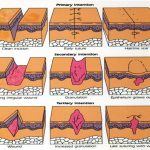 wound-care-and-management-workshop